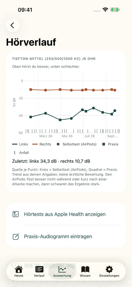 Hörverlauf mit Tiefton-Mittelwerten für linkes und rechtes Ohr