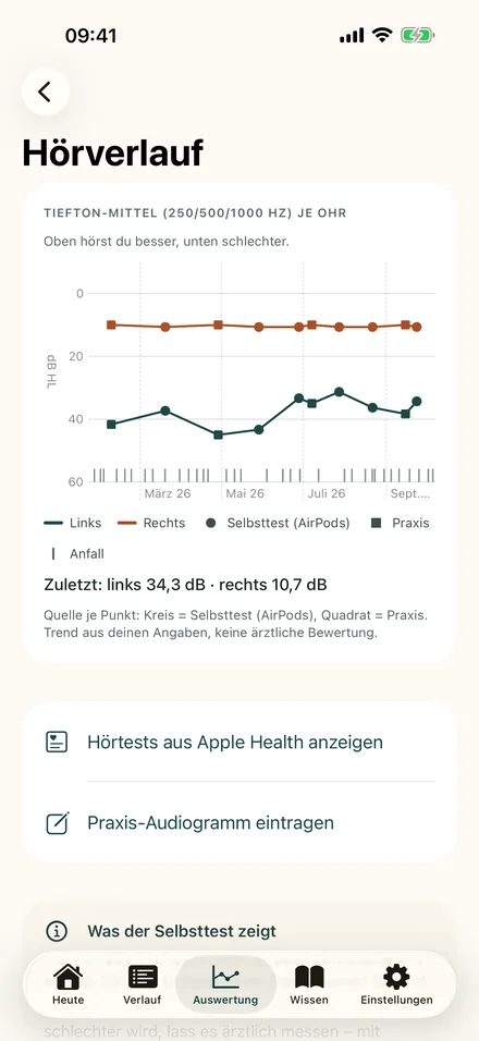 Hörverlauf mit Tiefton-Mittelwerten für linkes und rechtes Ohr