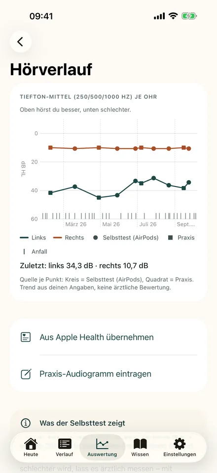 Hörverlauf mit Tiefton-Mittelwerten für linkes und rechtes Ohr